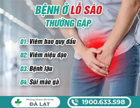 Hình ảnh minh họa